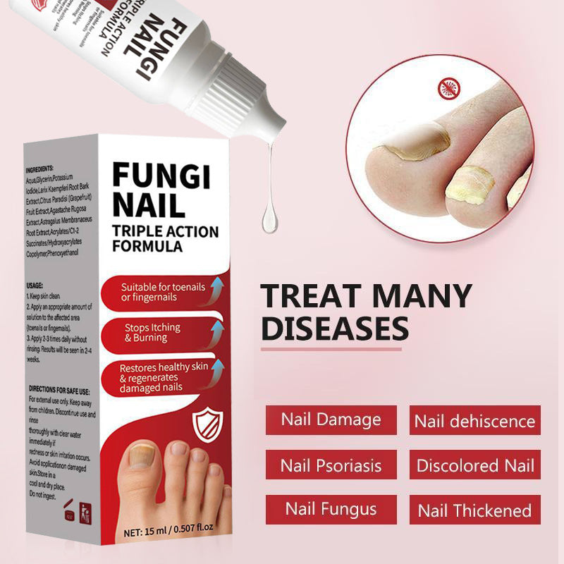 Triple Action Fungi Nail Treatment ✨ — Fast Relief & Nail Repair