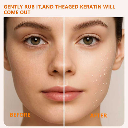 Glow Peel Gel ✨—Smooth skin in seconds