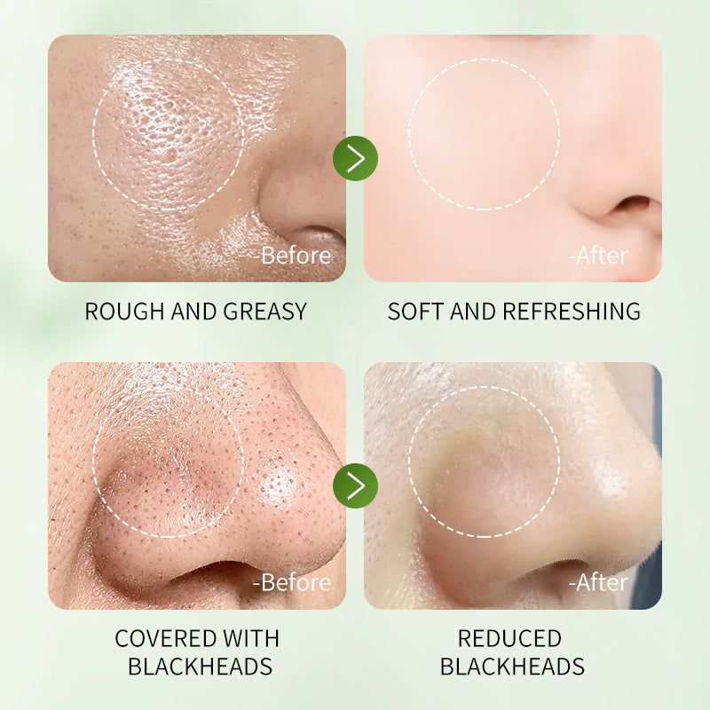 MUGWORT PLANT EXTRACT MUD MEMBRANE ROD