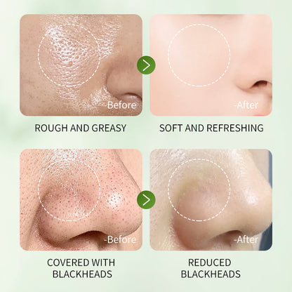 MUGWORT PLANT EXTRACT MUD MEMBRANE ROD