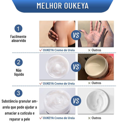 40% Urea Cream - Intensive Moisturizing Treatment