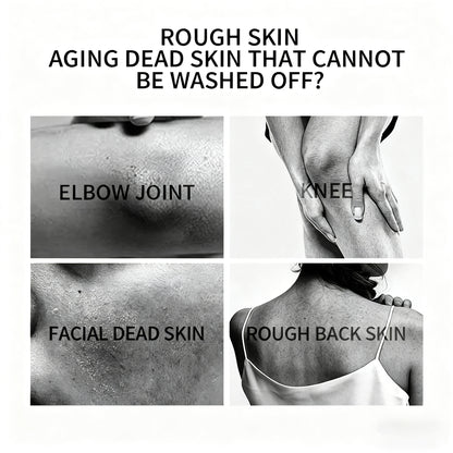 Glow Peel Gel ✨—Smooth skin in seconds