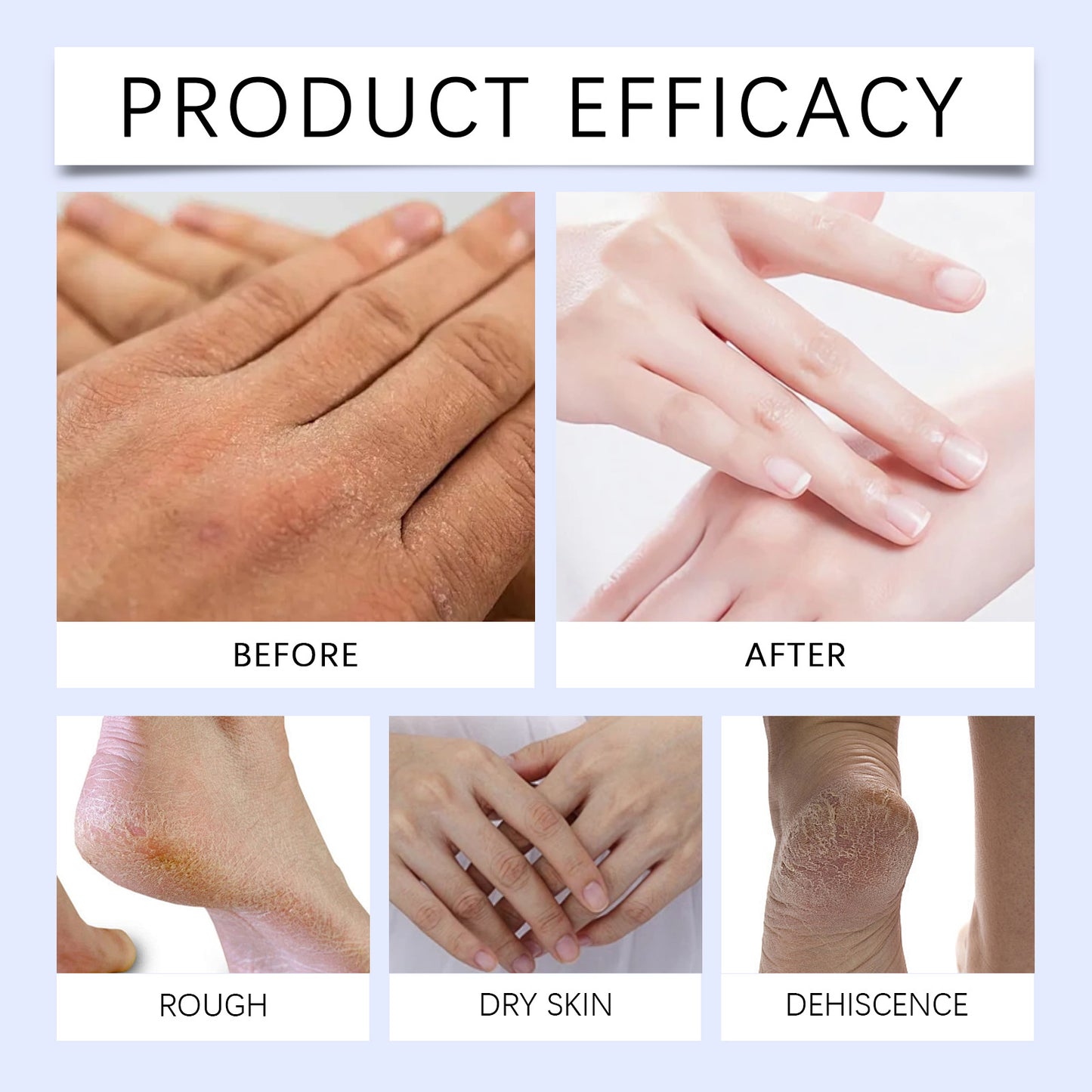 XIMONTH Intense Foot Cream