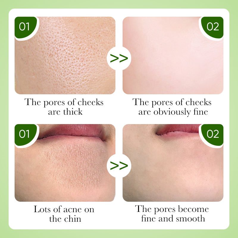 Charcoal Peel-Off Mask ✨ — Deep Cleanse & Remove Blackheads