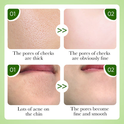 Charcoal Peel-Off Mask ✨ — Deep Cleanse & Remove Blackheads