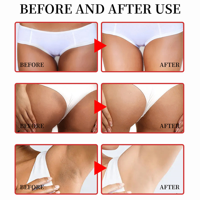 Lightening Cream ✨ — Remove Dark Spots & Brighten Skin