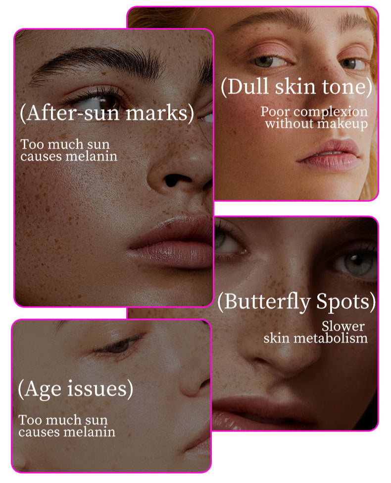 【Official Brand store】Black Spot Correcting & Repair Cream – For Face & Body Care